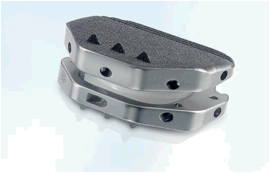Bandscheibenimplantat (2)