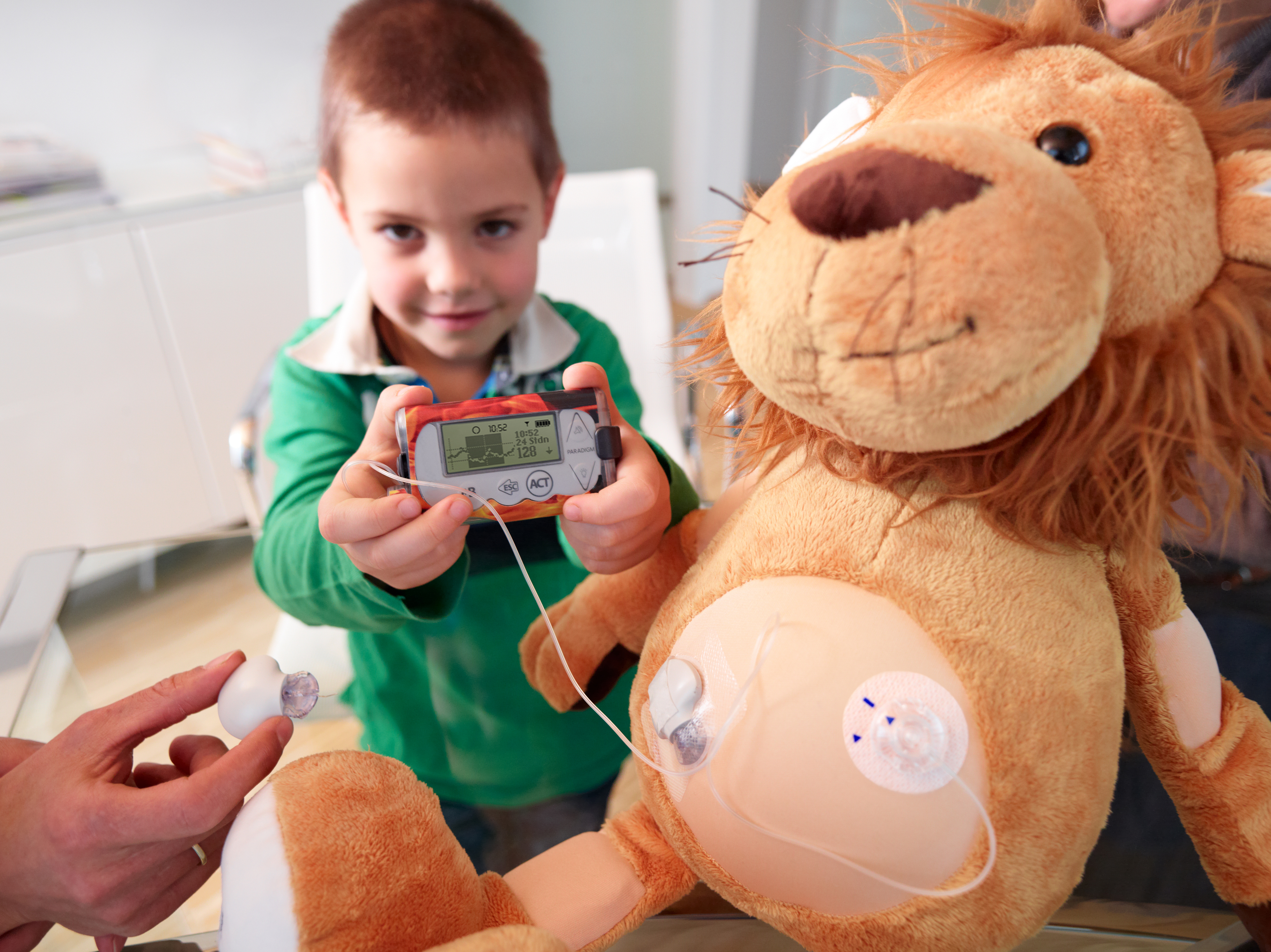 Kontinuierliche Glukosemessung bei Kindern mit Diabetes