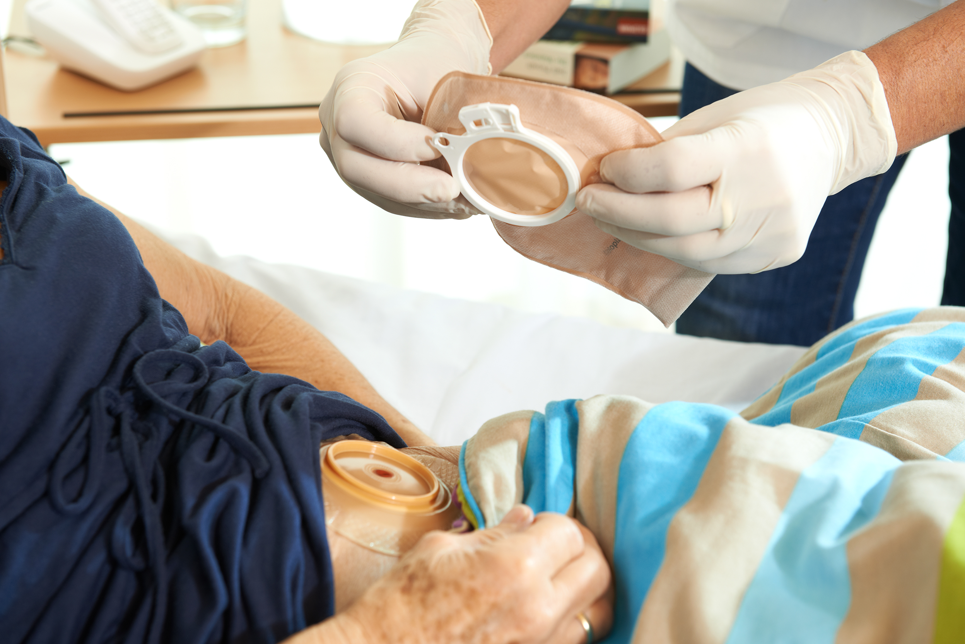 Homecare-Therapien: Stoma-Versorgung