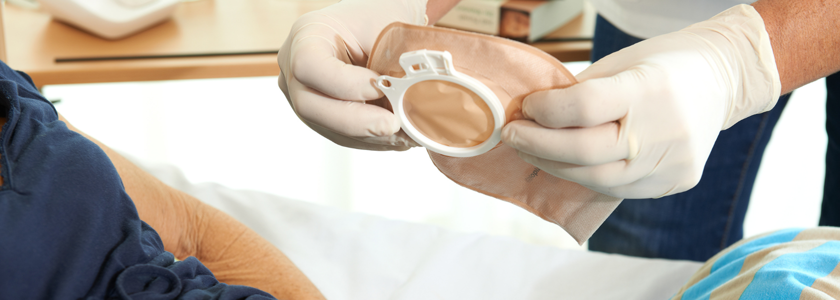 Stoma - BVMed
